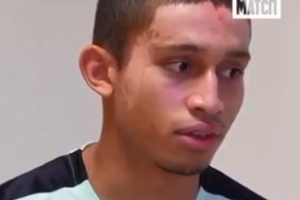 梅斯19岁小将与女友度假被严重烧伤：现在没法想足球，只想康复好